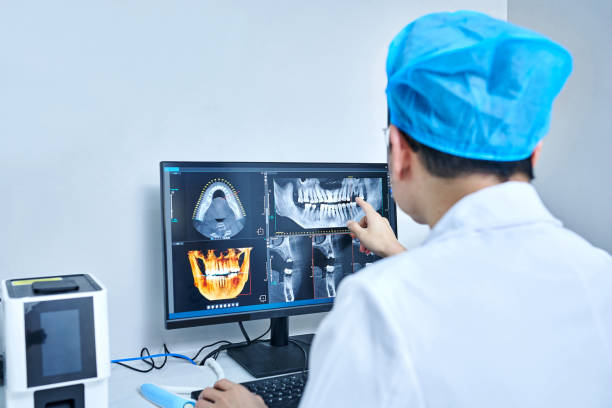 Best Emergency Dentist for Lost Fillings or Crowns in Kennewick, WA